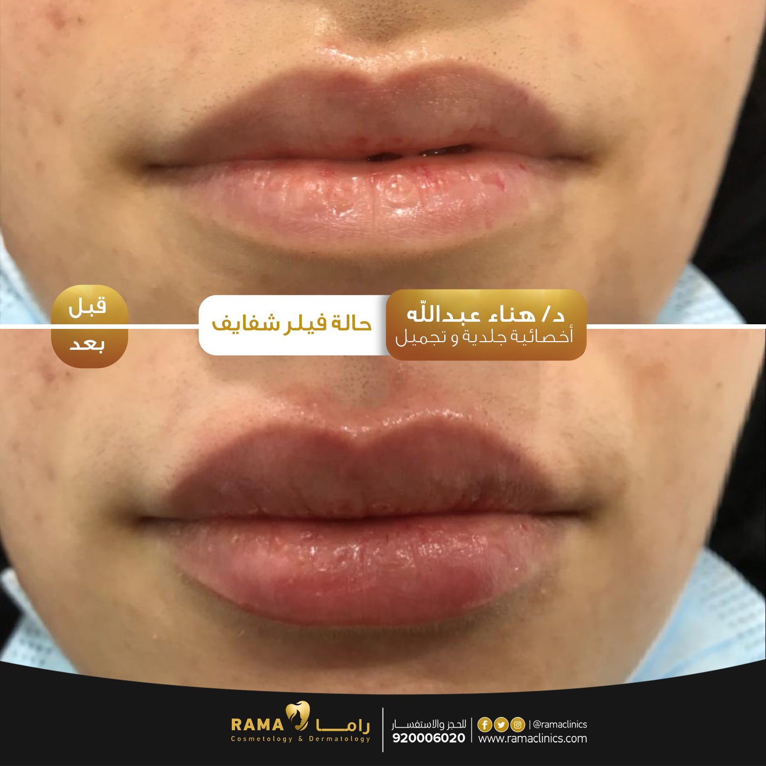 بعد العلاج