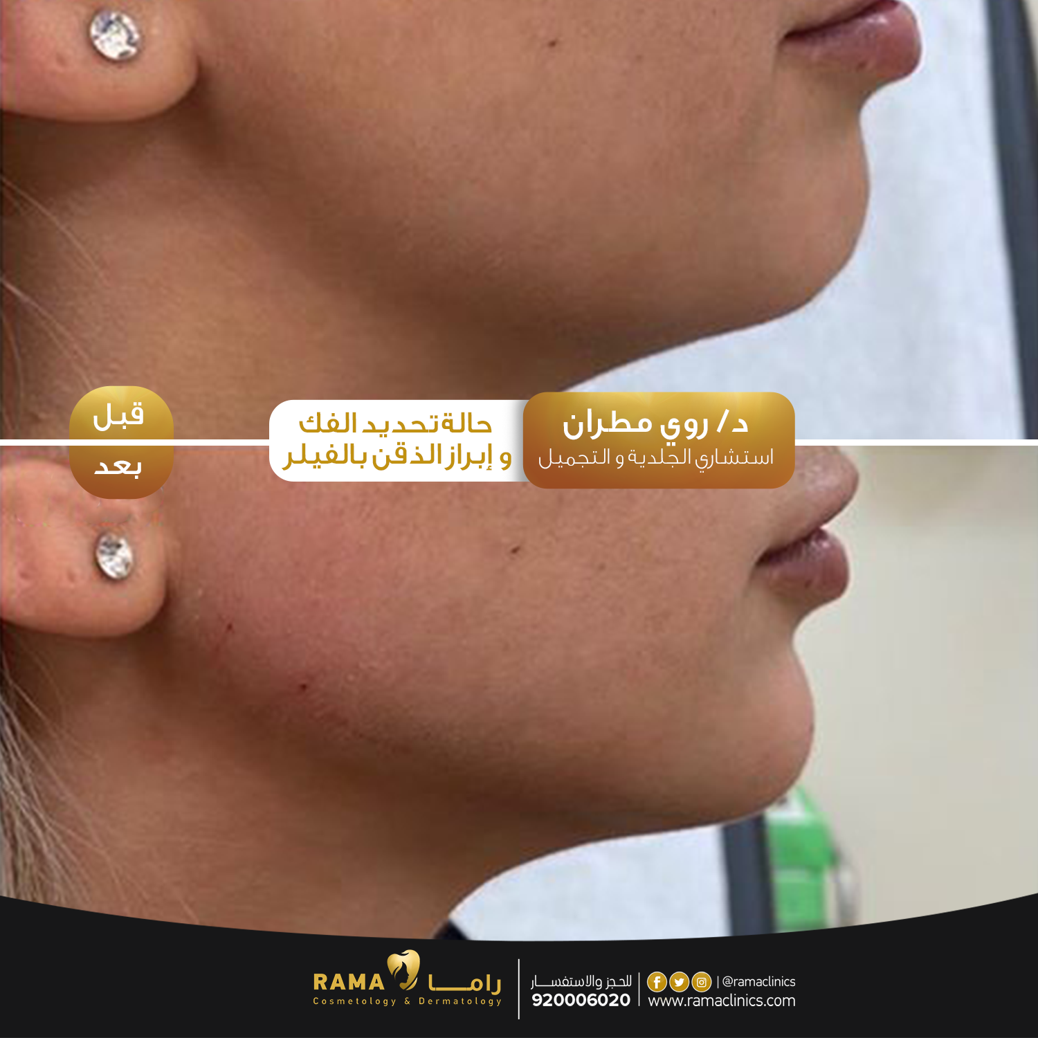 بعد العلاج
