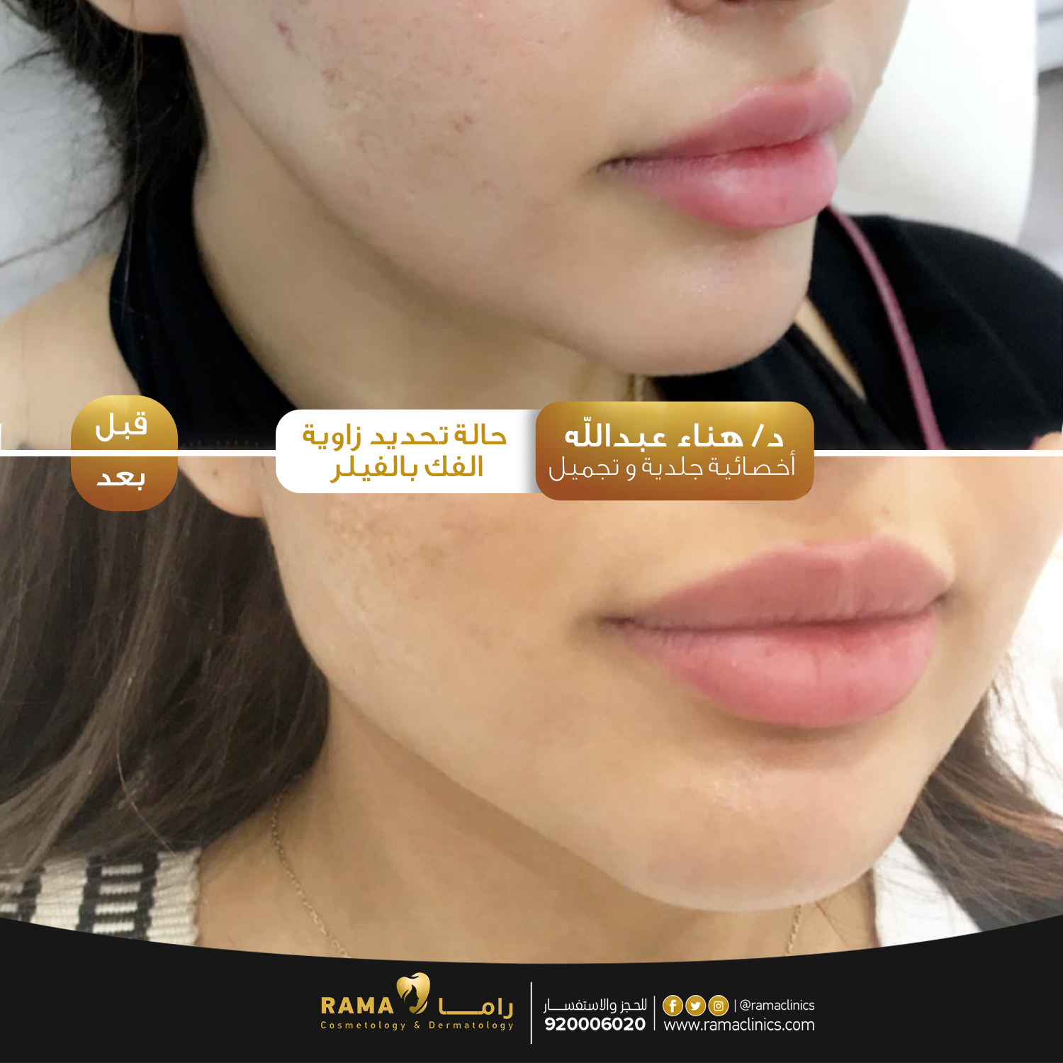 بعد العلاج