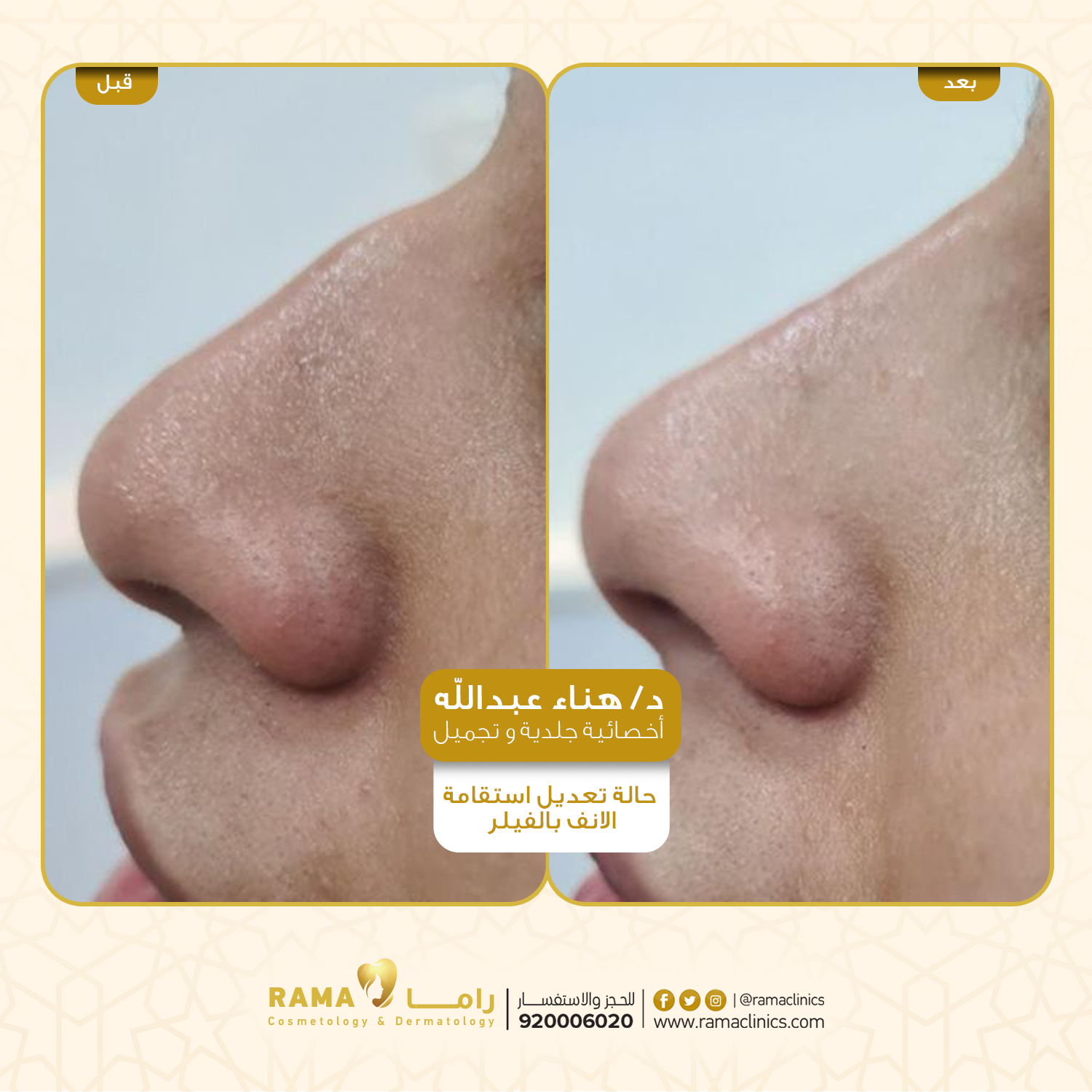 بعد العلاج