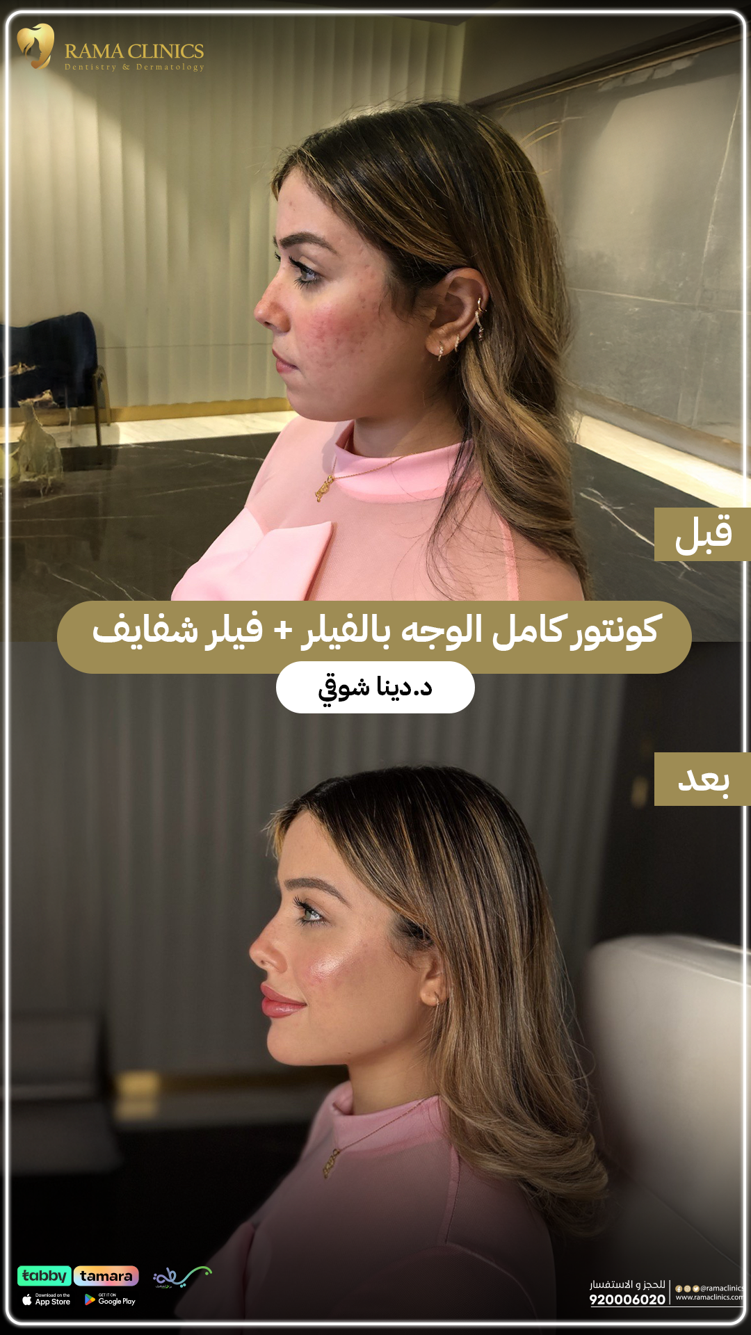 قبل العلاج