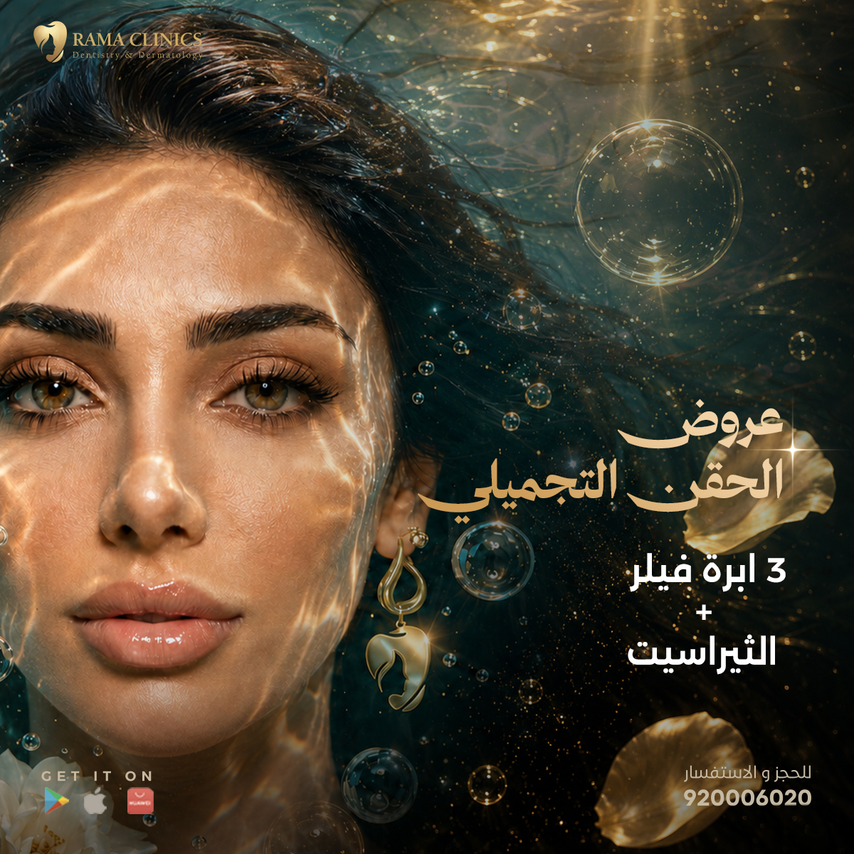 3 ابرة فيلر + الثيراسيت