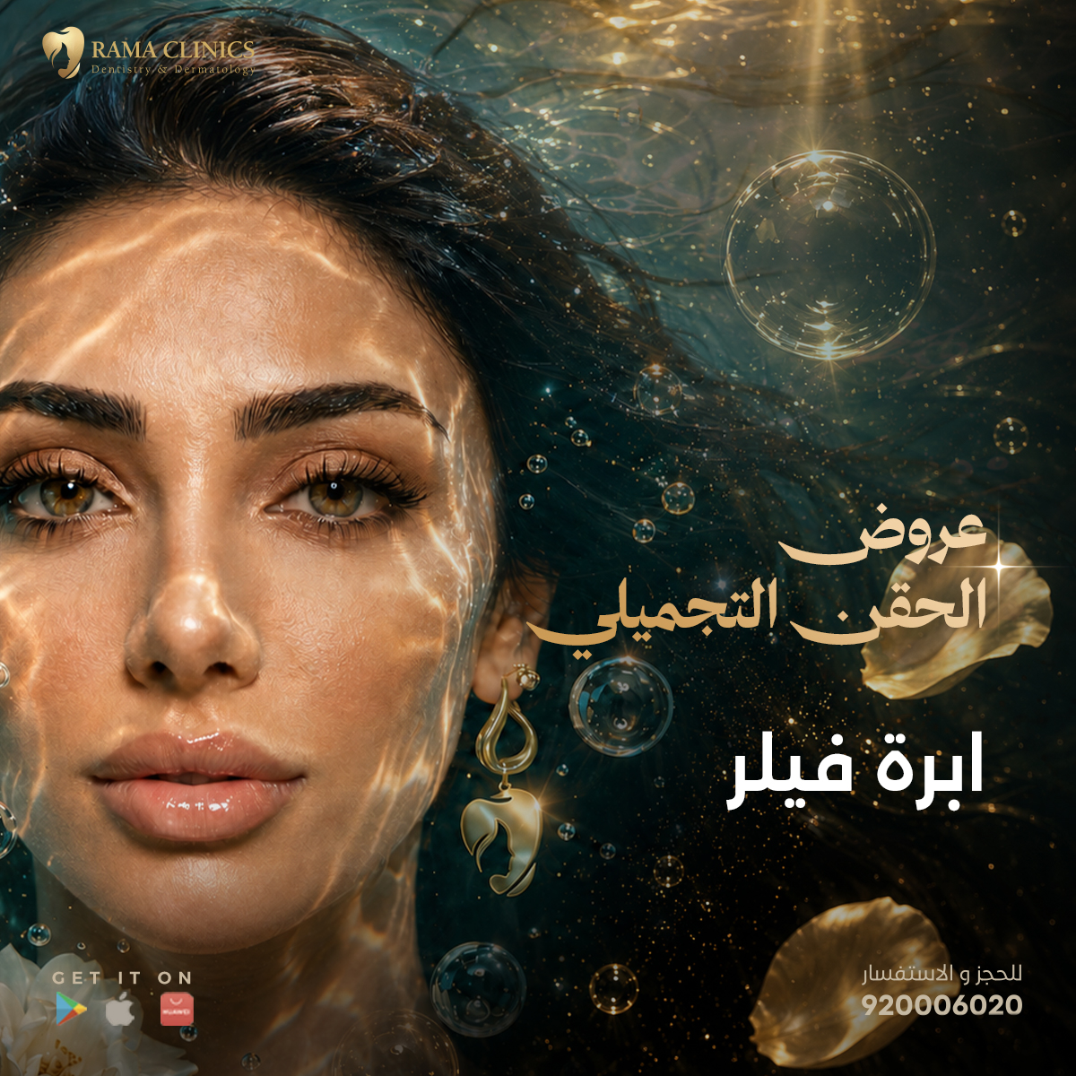 ابرة فيلر